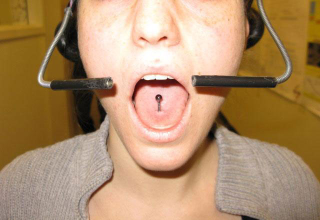 Tongue-Operated устройства помогают Парализованный People